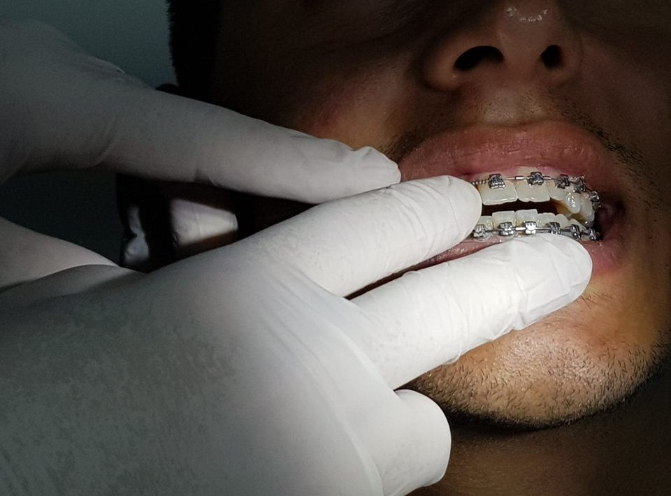 www.juicysantos.com.br - Aparelho dentário com baixo custo em Santos
